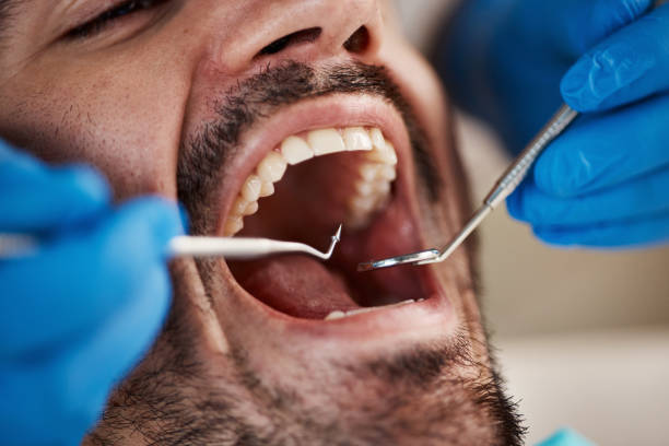 Best Urgent Tooth Repair  in East Sonora, CA