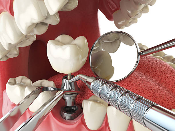 Best Dentist for Severe Toothache  in East Sonora, CA