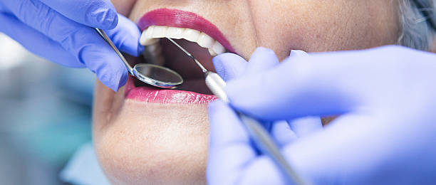 Best Dentist for Tooth Abscess  in East Sonora, CA